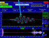 SB Real-Time, tensioned.gif (78121 bytes)